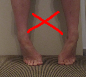 ankles incorrect alignment